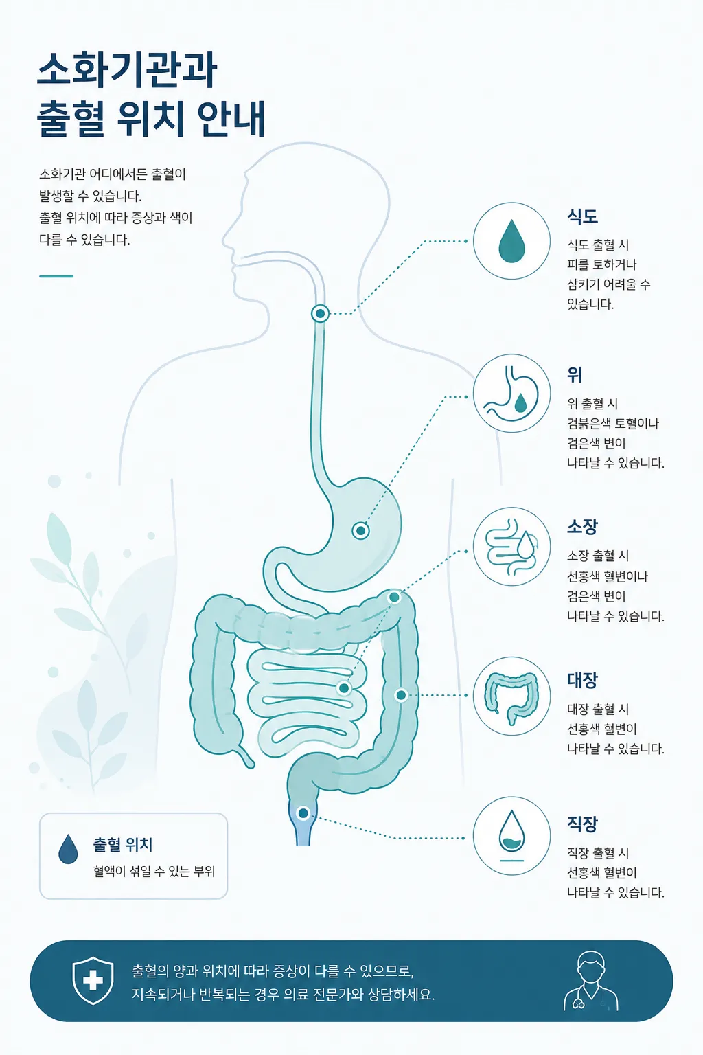 식도부터 직장까지 소화기관 부위별 출혈 위치를 표시한 인포그래픽 일러스트