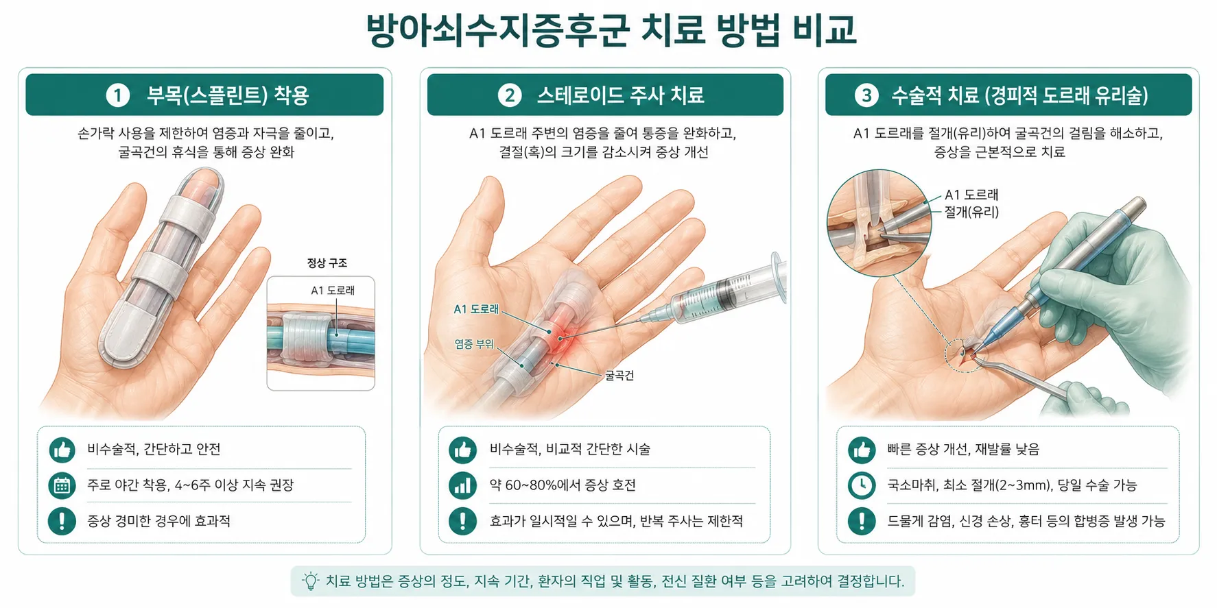 방아쇠수지증후군 치료 방법 비교 – 부목 착용, 스테로이드 주사, 수술적 치료
