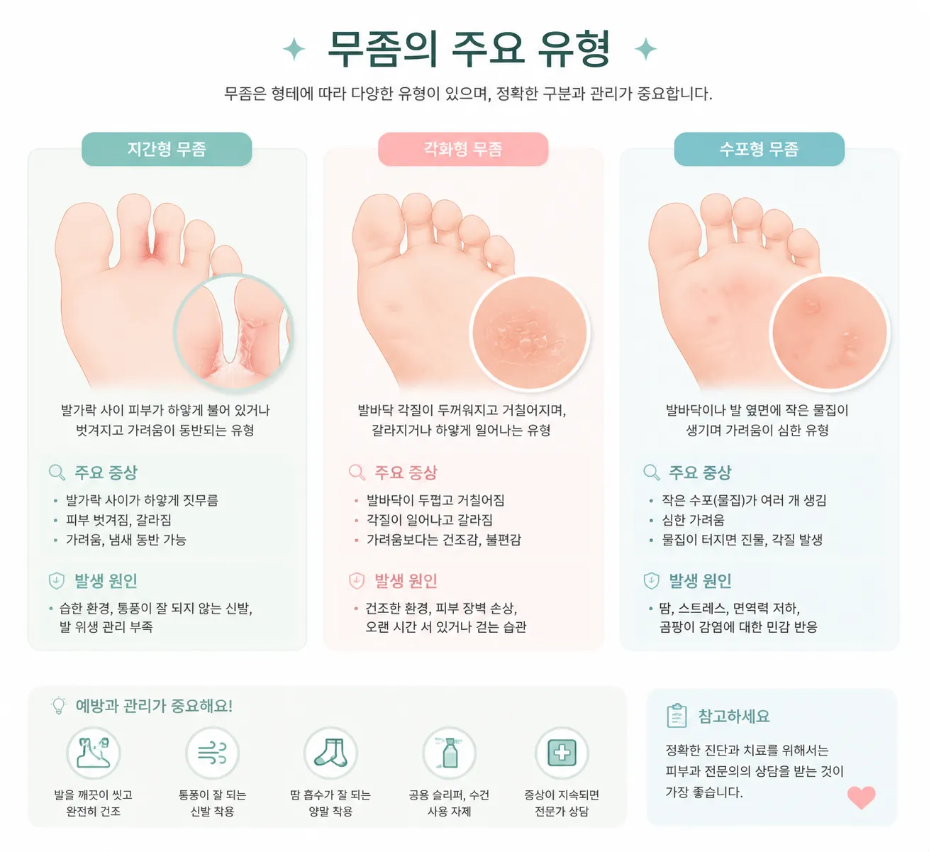 무좀의 세 가지 유형인 지간형, 각화형, 수포형을 구분해서 보여주는 인포그래픽 일러스트