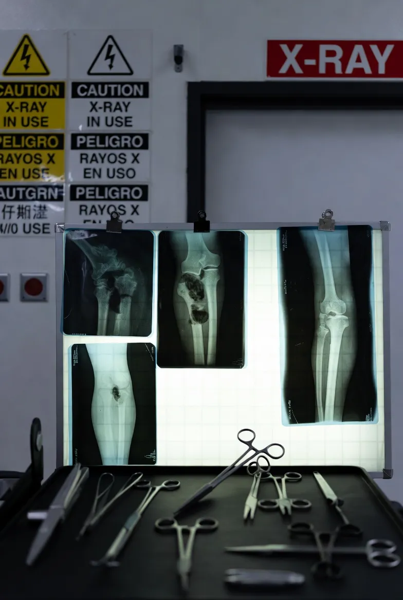 X-ray images, surgical tools, and a warning sign